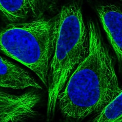 Invitrogen DTNBP1 Polyclonal Antibody:Antibodies:Primary Antibodies