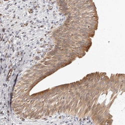 Invitrogen DTNBP1 Polyclonal Antibody:Antibodies:Primary Antibodies