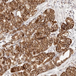 Invitrogen DTNBP1 Polyclonal Antibody 100 &mu;L; Unconjugated:Antibodies,