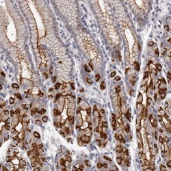 Invitrogen GPRC5C Polyclonal Antibody 100 &mu;L | Buy Online | Invitrogen&trade; | Fisher Scientific