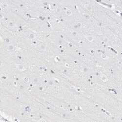 Invitrogen Cathelicidin Polyclonal Antibody 100 &mu;L; Unconjugated:Antistoffer