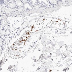 Invitrogen Cathelicidin Polyclonal Antibody 100 &mu;L; Unconjugated:Antistoffer