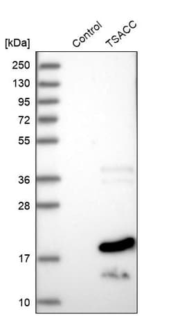 Invitrogen TSACC Polyclonal Antibody 100 &mu;L; Unconjugated:Antibodies,