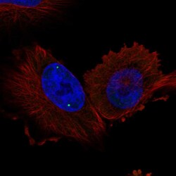 Invitrogen WRAP53 Polyclonal Antibody 100 μL; Unconjugated:Antibodies,