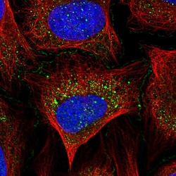 Invitrogen ABI1 Polyclonal Antibody 100 &mu;L; Unconjugated:Antibodies,