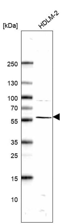 Invitrogen ABI1 Polyclonal Antibody 100 &mu;L; Unconjugated:Antibodies,