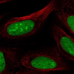 Invitrogen CRISPLD2 Polyclonal Antibody 100 &mu;L; Unconjugated:Antibodies,