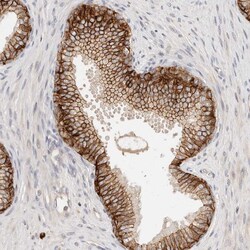 Invitrogen CAR Polyclonal Antibody:Antibodies:Primary Antibodies
