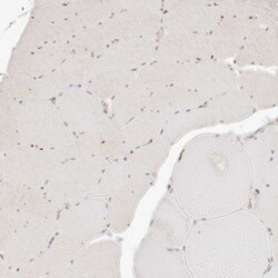 Invitrogen CAR Polyclonal Antibody:Antibodies:Primary Antibodies