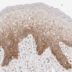 Invitrogen CAR Polyclonal Antibody:Antibodies:Primary Antibodies