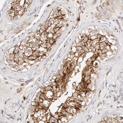 Invitrogen CAR Polyclonal Antibody:Antibodies:Primary Antibodies