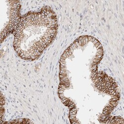 Invitrogen CAR Polyclonal Antibody 100 &mu;L; Unconjugated:Antibodies,