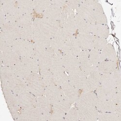 Invitrogen CAR Polyclonal Antibody 100 &mu;L; Unconjugated:Antibodies,
