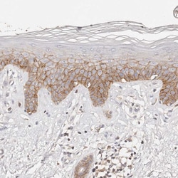 Invitrogen CAR Polyclonal Antibody 100 &mu;L; Unconjugated:Antibodies,