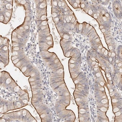 Invitrogen CAR Polyclonal Antibody 100 &mu;L; Unconjugated:Antibodies,