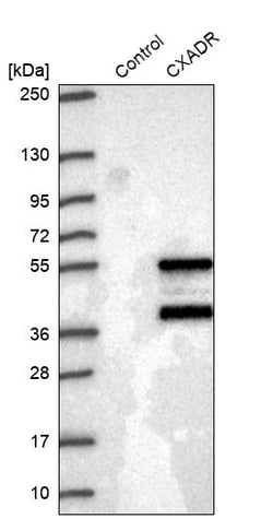 Invitrogen CAR Polyclonal Antibody:Antibodies:Primary Antibodies
