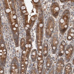 Invitrogen XPNPEP1 Polyclonal Antibody 100 &mu;L; Unconjugated:Antibodies,