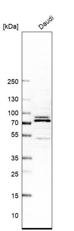 Invitrogen XPNPEP1 Polyclonal Antibody 100 &mu;L | Buy Online | Invitrogen&trade; | Fisher Scientific