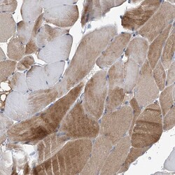 Invitrogen CD267 (TACI) Polyclonal Antibody 100 μL; Unconjugated:Antibodies,