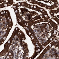 Invitrogen CD267 (TACI) Polyclonal Antibody 100 μL; Unconjugated:Antibodies,