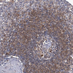 Invitrogen CD267 (TACI) Polyclonal Antibody 100 μL; Unconjugated:Antibodies,