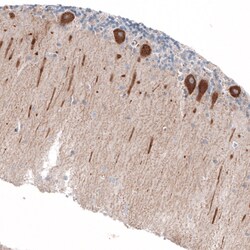 Invitrogen Jagged2 Polyclonal Antibody 100 &mu;L; Unconjugated:Antibodies,