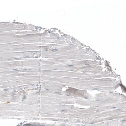 Invitrogen Jagged2 Polyclonal Antibody 100 &mu;L; Unconjugated:Antibodies,