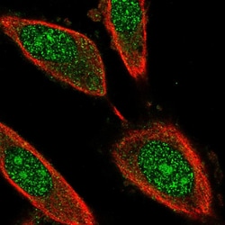 Invitrogen GRB2 Polyclonal Antibody:Antibodies:Primary Antibodies