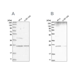 Invitrogen GRB2 Polyclonal Antibody 100 &mu;L; Unconjugated:Antibodies,