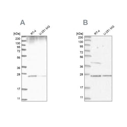 Invitrogen GRB2 Polyclonal Antibody 100 &mu;L; Unconjugated:Antibodies,