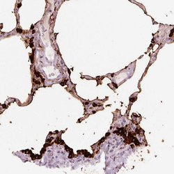 STEAP1 Polyclonal Antibody, Invitrogen 100 &mu;L; Unconjugated:Antibodies,