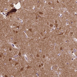 Invitrogen STEP Polyclonal Antibody:Antibodies:Primary Antibodies