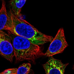 Invitrogen Albumin Polyclonal Antibody:Antibodies:Primary Antibodies