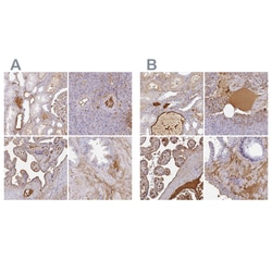 Invitrogen Albumin Polyclonal Antibody:Antibodies:Primary Antibodies
