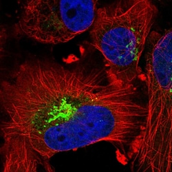Invitrogen CTGF Polyclonal Antibody 100 μL; Unconjugated:Antibodies,
