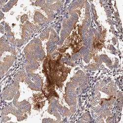 Invitrogen CTGF Polyclonal Antibody 100 μL; Unconjugated:Antibodies,