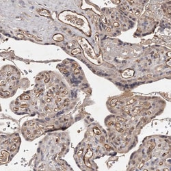 Invitrogen CTGF Polyclonal Antibody 100 μL; Unconjugated:Antibodies,