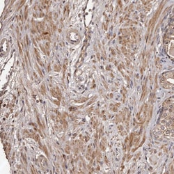 Invitrogen CTGF Polyclonal Antibody 100 μL; Unconjugated:Antibodies,
