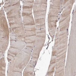 Invitrogen CTGF Polyclonal Antibody 100 μL; Unconjugated:Antibodies,