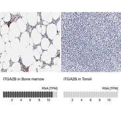 Invitrogen CD41 Polyclonal Antibody 100 &mu;L | Buy Online | Invitrogen&trade; | Fisher Scientific