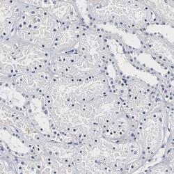 Invitrogen CD41 Polyclonal Antibody 100 &mu;L | Buy Online | Invitrogen&trade; | Fisher Scientific