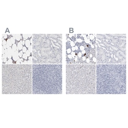 Invitrogen CD41 Polyclonal Antibody 100 &mu;L | Buy Online | Invitrogen&trade; | Fisher Scientific
