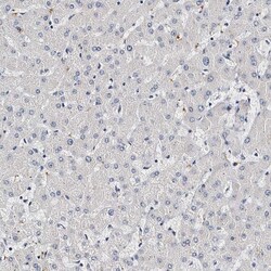 Invitrogen CD41 Polyclonal Antibody 100 &mu;L | Buy Online | Invitrogen&trade; | Fisher Scientific