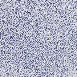Invitrogen CD41 Polyclonal Antibody 100 &mu;L | Buy Online | Invitrogen&trade; | Fisher Scientific