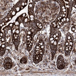 SEMA6A Polyclonal Antibody:Antibodies, Polyclonal