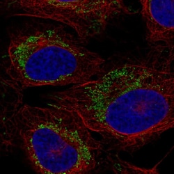 Invitrogen CCR7 Polyclonal Antibody GVKFRNDLFK LFKDLGCLSQ EQLRQWSSCR HIRRSSMSVE
