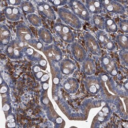Invitrogen ABCG1 Polyclonal Antibody 100 μL; Unconjugated:Antibodies,