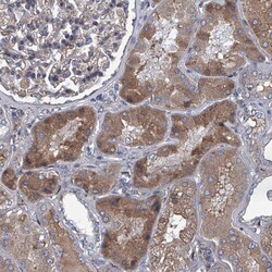 Invitrogen ABCG1 Polyclonal Antibody 100 μL; Unconjugated:Antibodies,