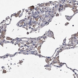 Invitrogen ABCG1 Polyclonal Antibody 100 μL; Unconjugated:Antibodies,