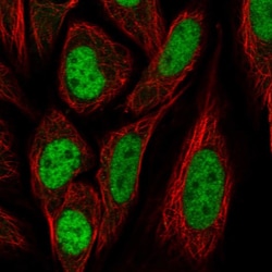 Invitrogen PPIL4 Polyclonal Antibody 100 &mu;L; Unconjugated:Antibodies,